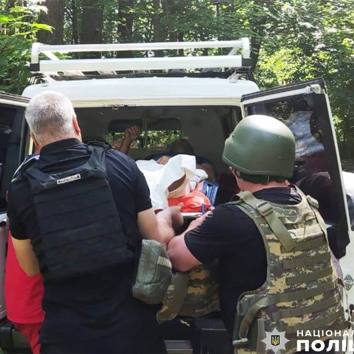 55-річний чоловік отримав поранення під час обстрілів